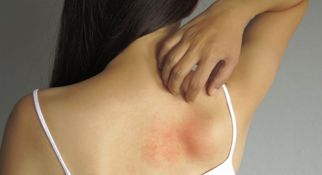 tratamento para fibromialgia